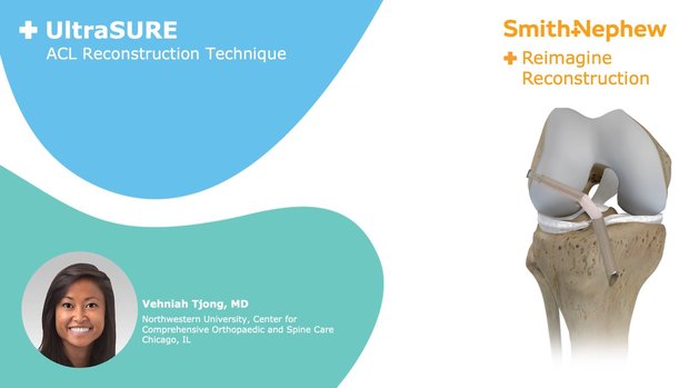 UltraSURE ACL Reconstruction Technique with ULTRABUTTON Adjustable ...