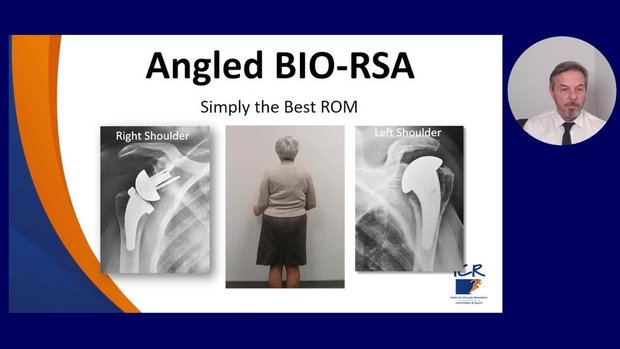 Why and How I Plan & Perform a BIO_RSA | Vumedi