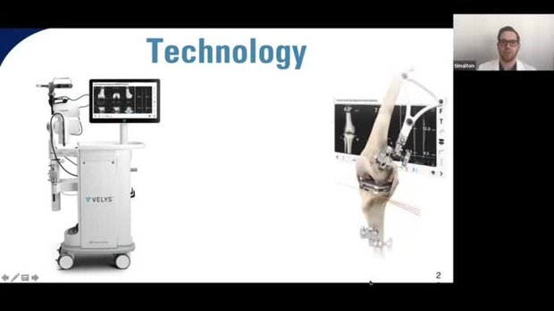 Patient Specific Alignment and Robotic Assisted TKA: Technique ...