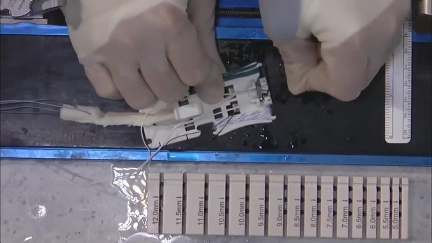 RIGIDLOOP™ BTB Adjustable Cortical System | Vumedi