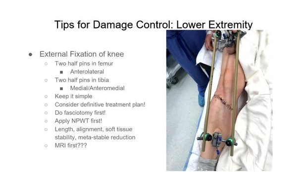 Tips for Damage Control: Lower Extremity - Early Total Care Versus ...