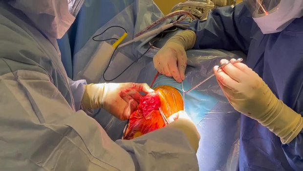 MQTFL Reconstruction after Patellofemoral Replacement | Vumedi