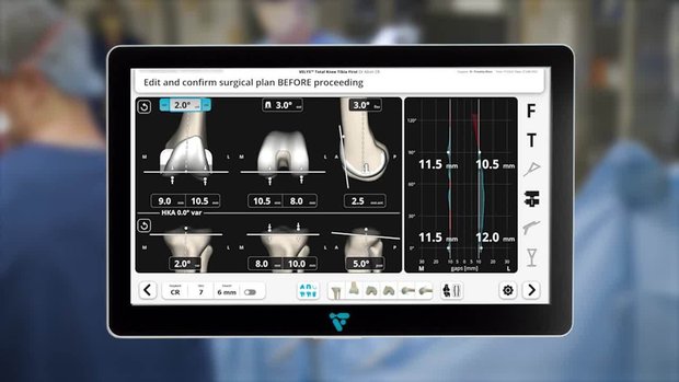 Surgical Technique for TKA with VELYS Robotic Assisted Solution | Vumedi