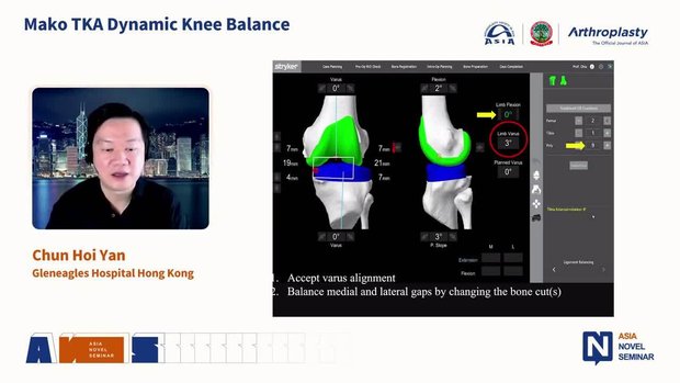 TKA Dynamic Knee Balance | Vumedi