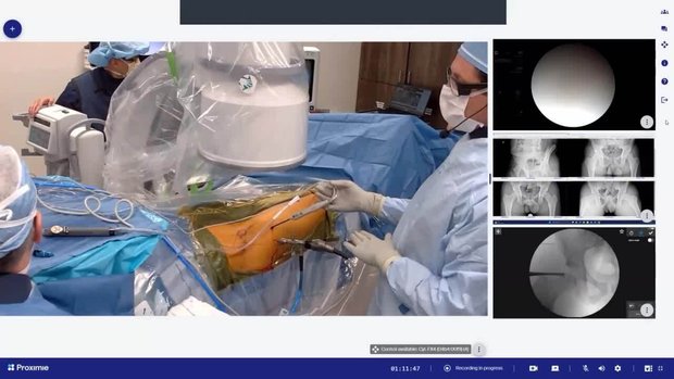 Live Surgery Broadcast: Efficient, Anatomic, Knotless Repair of the ...