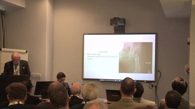 A Van Nes Rotationplasty is NOT an Obstacle for Hip Arthroscopy | Vumedi