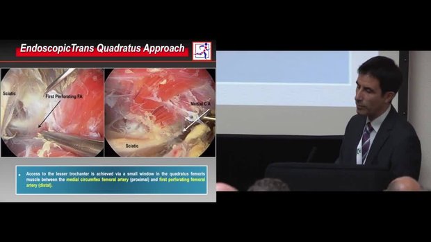 Short External Rotators and the Sciatic Nerve | Vumedi