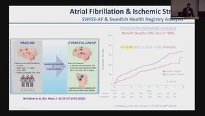 Arrhythmias - Treatments - Swiss Ablation