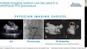 Pulsed Field Ablation: Catheter Design, Dosing Strategy, and Clinical ...