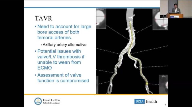UCLA Health | Vumedi