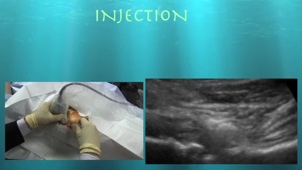 Case Presentations: Routine Hip Injection and Sterile Prep Breakdown ...