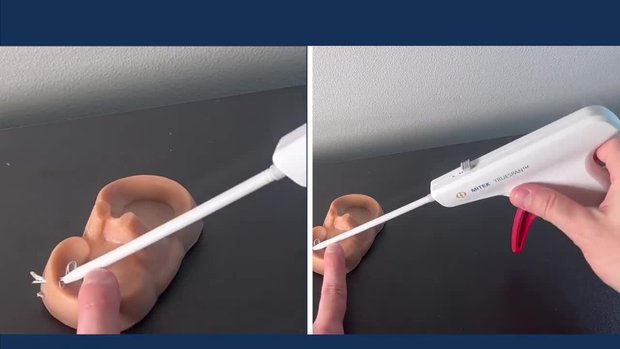 TRUESPAN Meniscal Repair Device Demonstration | Vumedi