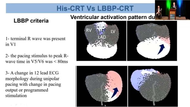 Physiology and Hemodynamics of CSP | Vumedi