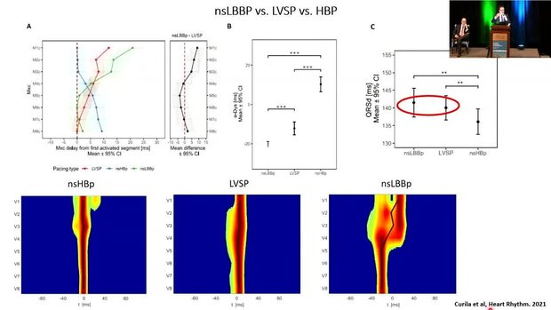 CSP Activation Patterns Using Non-Invasive Methods | Vumedi