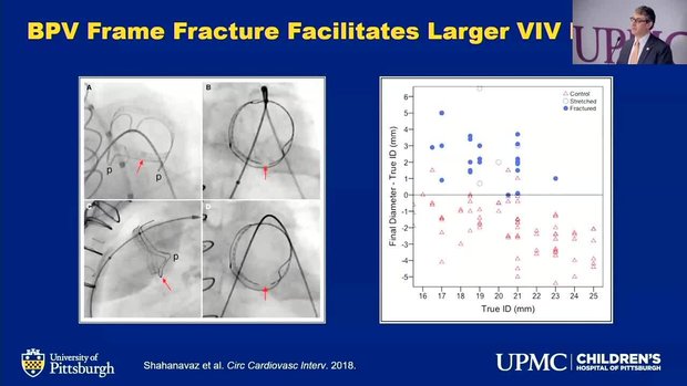 TPVR in Adults with Congenital Heart Disease | Vumedi