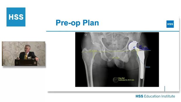 Femoral and Acetabular Revision Total Hip Surgical Video | Vumedi