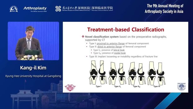 Management of Periprosthetic Distal Femoral Fracture Around TKA: Novel ...