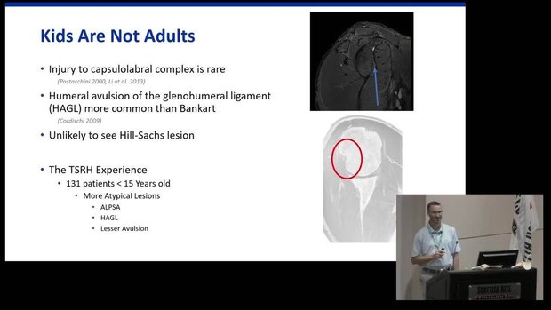 Management of Acute Shoulder Instability in Young Athletes | Vumedi