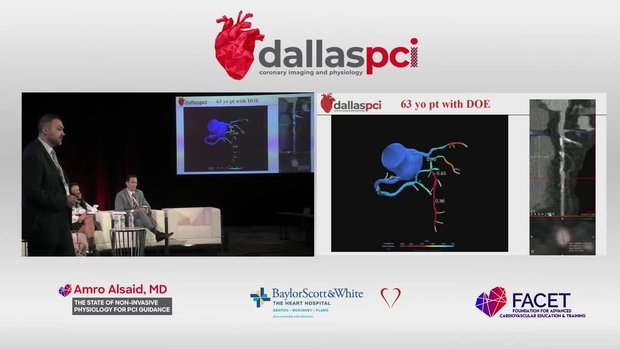 The State of Non-Invasive Physiology for PCI Guidance | Vumedi