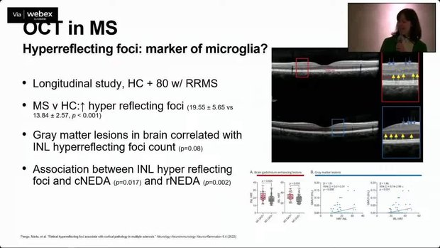 Visual Outcomes in MS Research | Vumedi