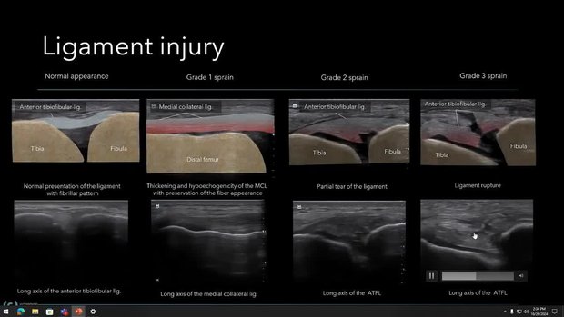 The Capabilities of MSK Ultrasound in Pediatrics - A Case-Based ...