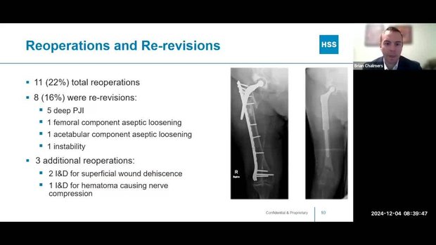 opathic Medical Repertory 洋書 Operative Hip Arthroscopy: 9781441979247: Medicine & Health