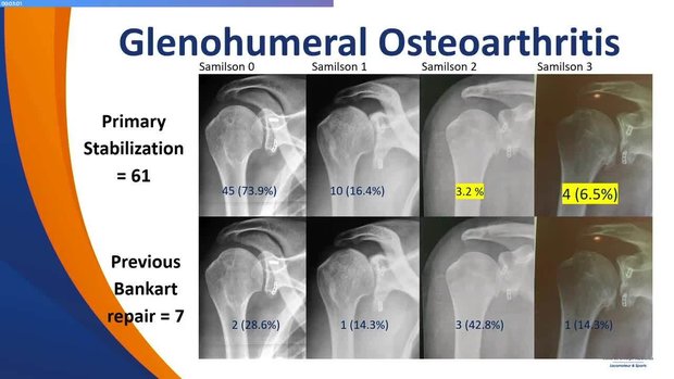 2024 Nice Shoulder Course | Vumedi