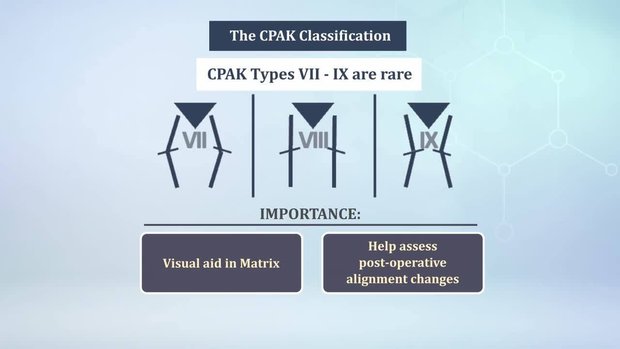 Knee Alignment Series Video 4: The Principles of CPAK | Vumedi