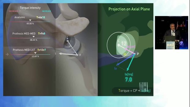 Understanding Biology and Biomechanics in Reverse Shoulder Arthroplasty ...