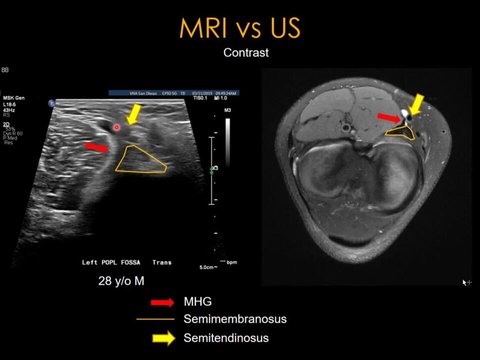 Clinical Imaging of the MSK System: Advantages and Limitations of ...