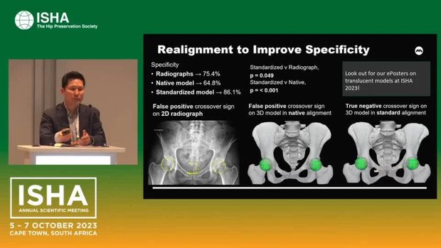A New Dimension in Hip Analysis: The Use of 3D Models to Explore Hip ...