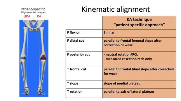 Kinematic Alignment - Resurfacing the Pre-Arthitic Knee Is the Answer ...