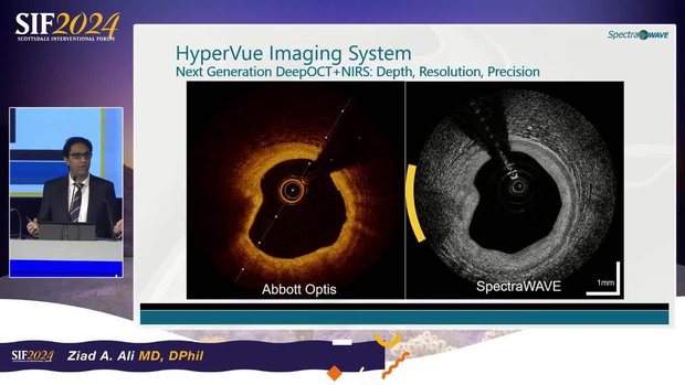 SpectraWAVE - HyperVue Imaging System | Vumedi