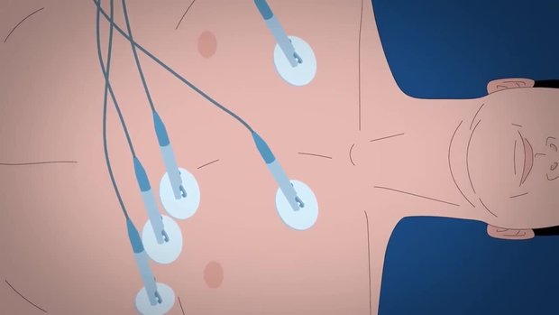 What to Expect During a CCTA? | Vumedi