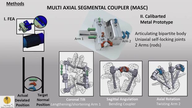 A Novel Concept and Device for Automation of 3D Correction of Spinal ...
