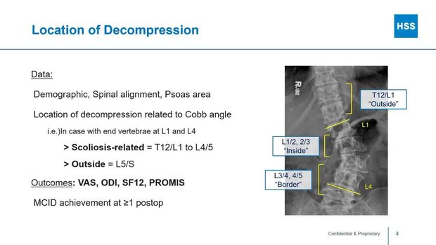 Impact of Decompression Location in MIS Decompression Alone: Focusing ...