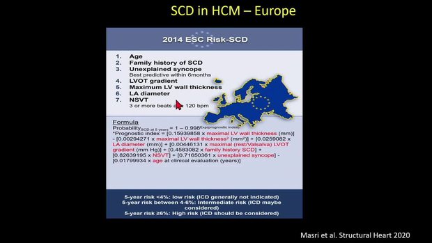 Hypertrophic Cardiomyopathy: Device Management | Vumedi