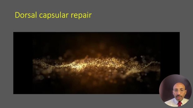 Arthroscopic TFCC repair | Vumedi