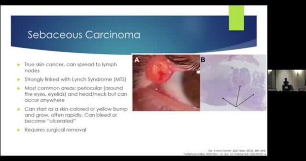 Lynch Syndrome and Skin: A Dermatologist’s Perspective | Vumedi
