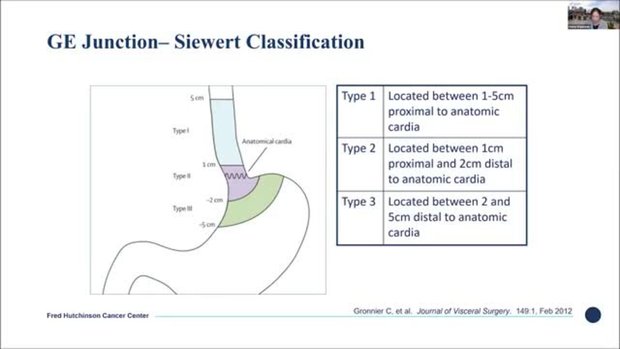 Overview of Esophageal & Gastric Cancer Diagnosis & Staging | Vumedi