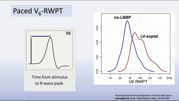 Methods and Maneuvers to Identify Conduction System Capture During ...