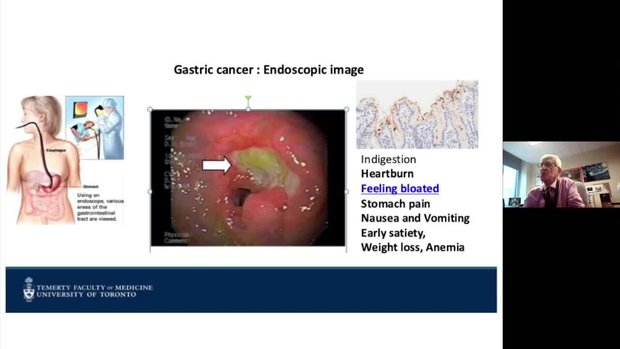 Gastrointestinal Red Flag Signs for the Primary Care Physician | Vumedi