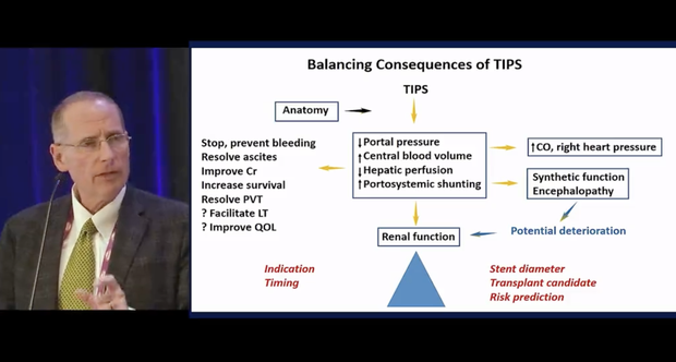 Demystification of TIPS Patient Selection | Vumedi