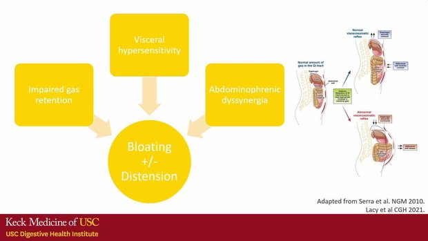 Belching, Abdominal Bloating, Distention and Everything in Between | Vumedi