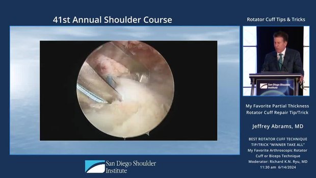 My Favorite Partial Thickness Rotator Cuff Repair Technique Trick | Vumedi