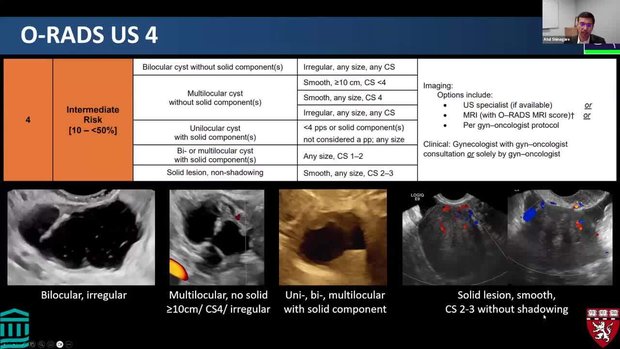 Using Ovarian-Adnexal Reporting & Data System (O-RADS) for Cancer ...
