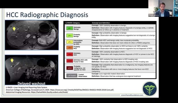 Early HCC: Surveillance and Diagnosis | Vumedi