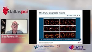 MI with Non-Obstructive Coronary Arteries (MINOCA): Is That a Thing ...