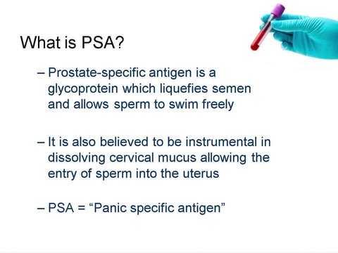 PSA Testing in Prostate Cancer Diagnosis | Vumedi