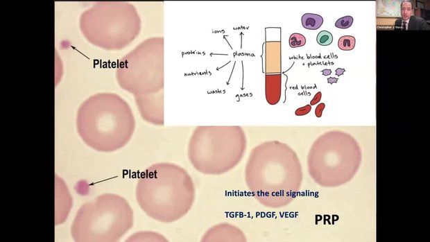 what happens when you stop taking bpc 157 BPC-157 Peptide Therapy Beverly Hills